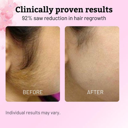 Essence Serum for Hair Removal